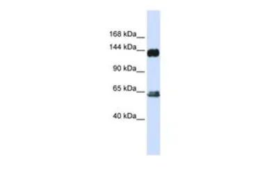 Anti-C3G antibody, C-term used in Western Blot (WB). GTX45384