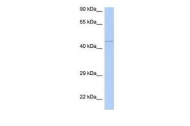 Anti-PAOX antibody, Internal used in Western Blot (WB). GTX45444