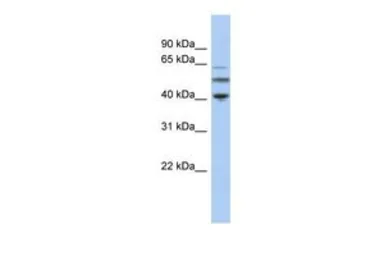 Anti-TUBA3C antibody, N-term used in Western Blot (WB). GTX45482