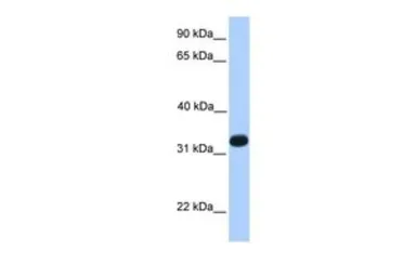 Anti-ACRV1 antibody, N-term used in Western Blot (WB). GTX45490