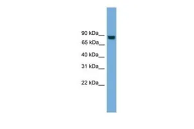 Anti-EXOC8 antibody, N-term used in Western Blot (WB). GTX45557