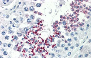 Anti-KLB antibody, Internal used in IHC (Paraffin sections) (IHC-P). GTX45558