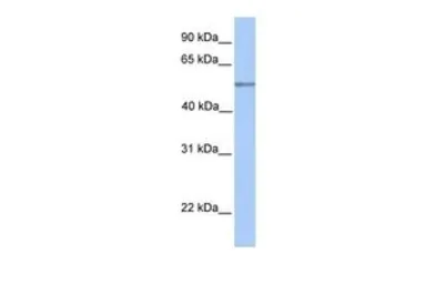 Anti-C17ORF74 antibody, Internal used in Western Blot (WB). GTX45559