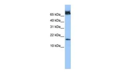 Anti-FUNDC1 antibody, N-term used in Western Blot (WB). GTX45570