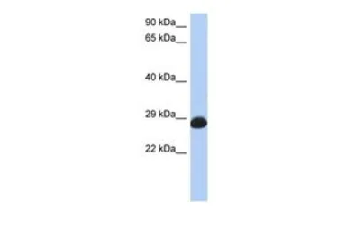Anti-RAB39B antibody, N-term used in Western Blot (WB). GTX45591