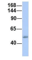 Anti-SH2D3C antibody, N-term used in Western Blot (WB). GTX45592