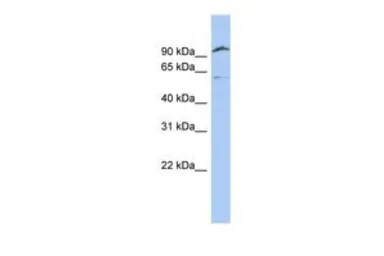 Anti-Matriptase 2 antibody, N-term used in Western Blot (WB). GTX45599