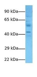 Anti-ARL13B antibody, Internal used in Western Blot (WB). GTX45702