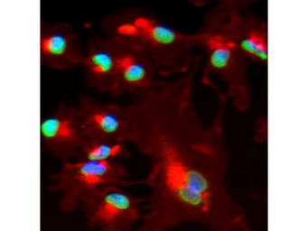 Anti-Bmi1 antibody used in Immunocytochemistry/ Immunofluorescence (ICC/IF). GTX45791