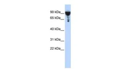 Anti-SEC6 antibody, Internal used in Western Blot (WB). GTX45794