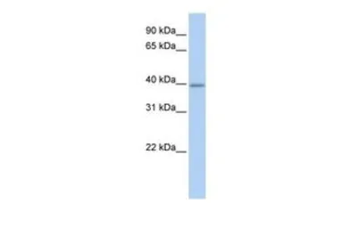 Anti-TXNIP antibody, C-term used in Western Blot (WB). GTX45803