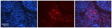 Anti-Arp3 antibody, N-term used in IHC (Paraffin sections) (IHC-P). GTX45806