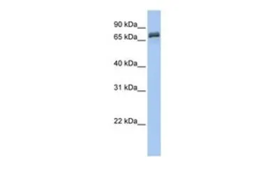 Anti-DYNC1I1 antibody, N-term used in Western Blot (WB). GTX45809