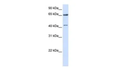 Anti-CCDC19 antibody, N-term used in Western Blot (WB). GTX45860