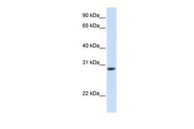 Anti-Troponin T fast skeletal antibody, C-term used in Western Blot (WB). GTX45865