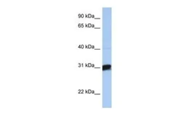 Anti-B3GALT6 antibody, C-term used in Western Blot (WB). GTX45882
