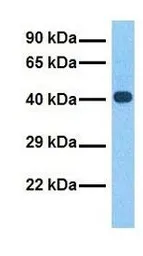 Anti-CYTB antibody, N-term used in Western Blot (WB). GTX45884