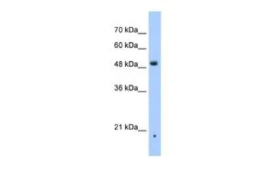 Anti-ZDHHC16 antibody, N-term used in Western Blot (WB). GTX45926