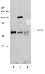 Anti-SYT3 antibody, N-term used in Western Blot (WB). GTX45928