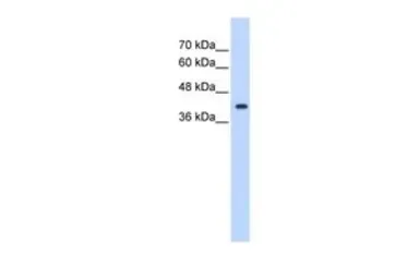 Anti-ST6GALNAC5 antibody, Internal used in Western Blot (WB). GTX45949