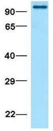 Anti-SUN1 antibody, N-term used in Western Blot (WB). GTX45959