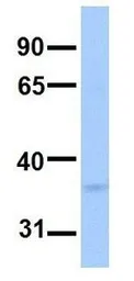 Anti-LPPR2 antibody, Internal used in Western Blot (WB). GTX46008