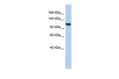 Anti-TMEM63C antibody, Internal used in Western Blot (WB). GTX46055