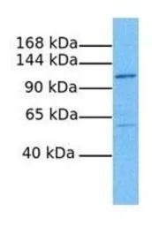 Anti-TMEM63C antibody, Internal used in Western Blot (WB). GTX46055