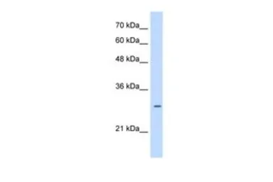 Anti-LRRC59 antibody, Internal used in Western Blot (WB). GTX46087