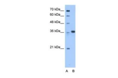 Anti-AASDHPPT antibody, C-term used in Western Blot (WB). GTX46193