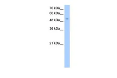Anti-MFNG antibody, Internal used in Western Blot (WB). GTX46214