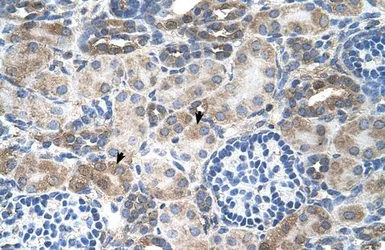 Anti-SLC14A1 antibody, C-term used in IHC (Paraffin sections) (IHC-P). GTX46258