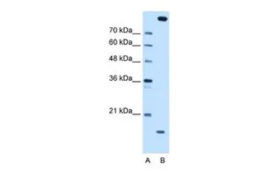 Anti-CTAGE5 antibody, Internal used in Western Blot (WB). GTX46272