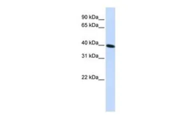 Anti-CARKD antibody, Internal used in Western Blot (WB). GTX46301