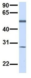 Anti-TMEM57 antibody, N-term used in Western Blot (WB). GTX46302