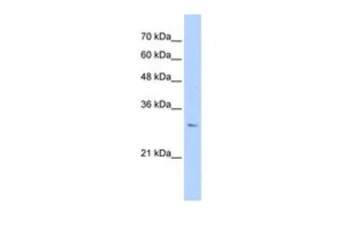 Anti-RHBDL2 antibody, N-term used in Western Blot (WB). GTX46323