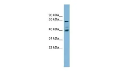 Anti-TM9SF4 antibody, N-term used in Western Blot (WB). GTX46367