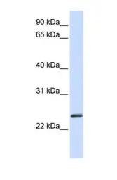 Anti-ERVWE1 antibody, N-term used in Western Blot (WB). GTX46373