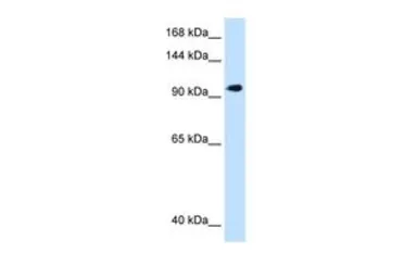 Anti-SEC63 antibody, C-term used in Western Blot (WB). GTX46399