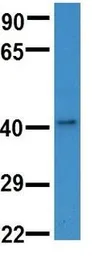 Anti-HS3ST3B1 antibody, N-term used in Western Blot (WB). GTX46416