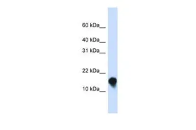 Anti-FXYD1 antibody, N-term used in Western Blot (WB). GTX46429