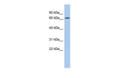 Anti-ERP72 antibody, N-term used in Western Blot (WB). GTX46431
