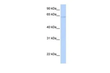 Anti-PPAT antibody, C-term used in Western Blot (WB). GTX46491