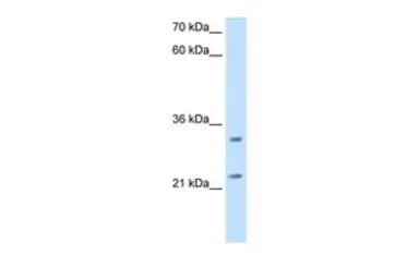 Anti-C21ORF33 antibody, N-term used in Western Blot (WB). GTX46523