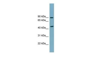Anti-SMPD2 antibody, N-term used in Western Blot (WB). GTX46558