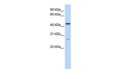 Anti-ACBD5 antibody, C-term used in Western Blot (WB). GTX46592