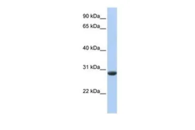 Anti-CLDND1 antibody, Internal used in Western Blot (WB). GTX46595