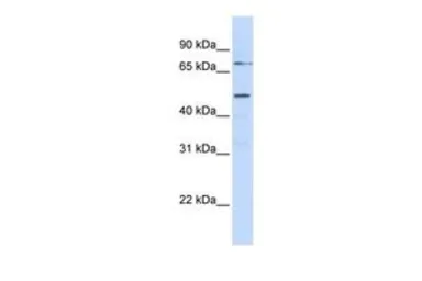 Anti-KREMEN1 antibody, N-term used in Western Blot (WB). GTX46605