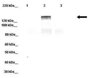 Anti-DPP6 antibody, Internal used in Western Blot (WB). GTX46611