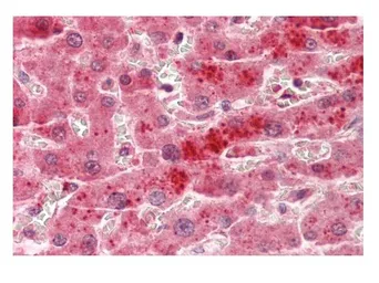 Anti-TSPAN4 antibody, Internal used in IHC (Paraffin sections) (IHC-P). GTX46637